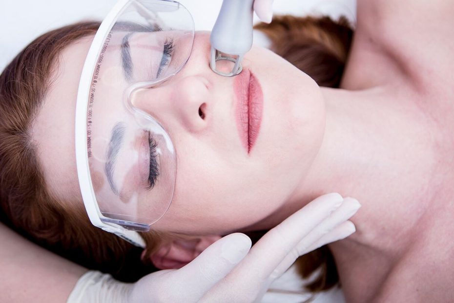 Benefits of Laser Facial Skin Rejuvenation