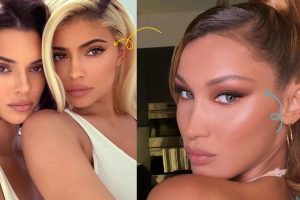 Thread Lift Procedure Offers Fantastic Results