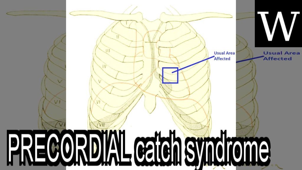 Precordial Catch Syndrome Symptoms