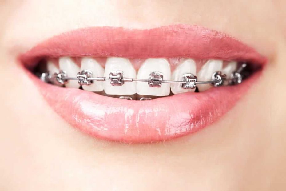 What is New in Orthodontics