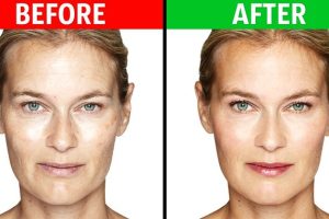 best ways to reduce wrinkles