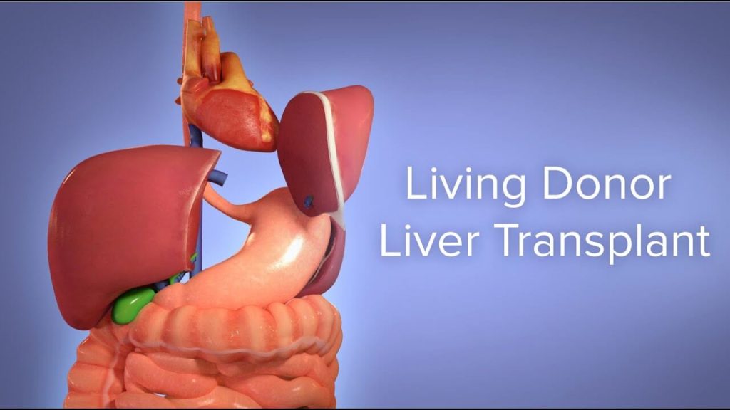 Liver Transplant Complications