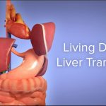 Liver Transplant Complications