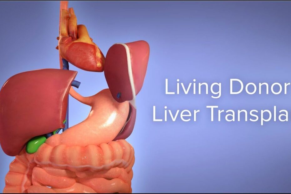 Liver Transplant Complications