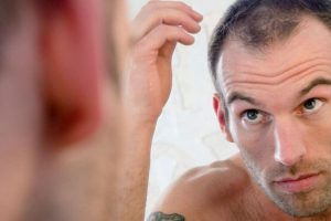 What all You Need to Know About an FUE Hair Transplant