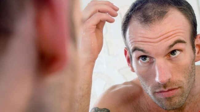What all You Need to Know About an FUE Hair Transplant