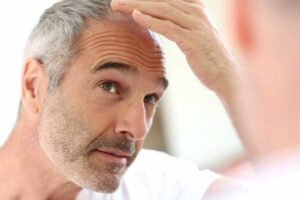 hair growth treatments to cure hair loss
