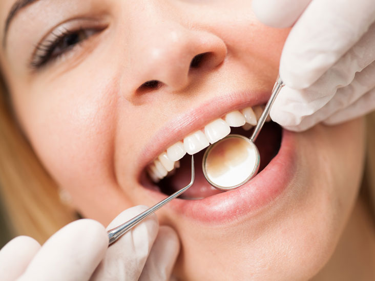 Professional Teeth Cleaning