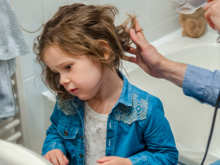 Focus on Hair Loss in Children