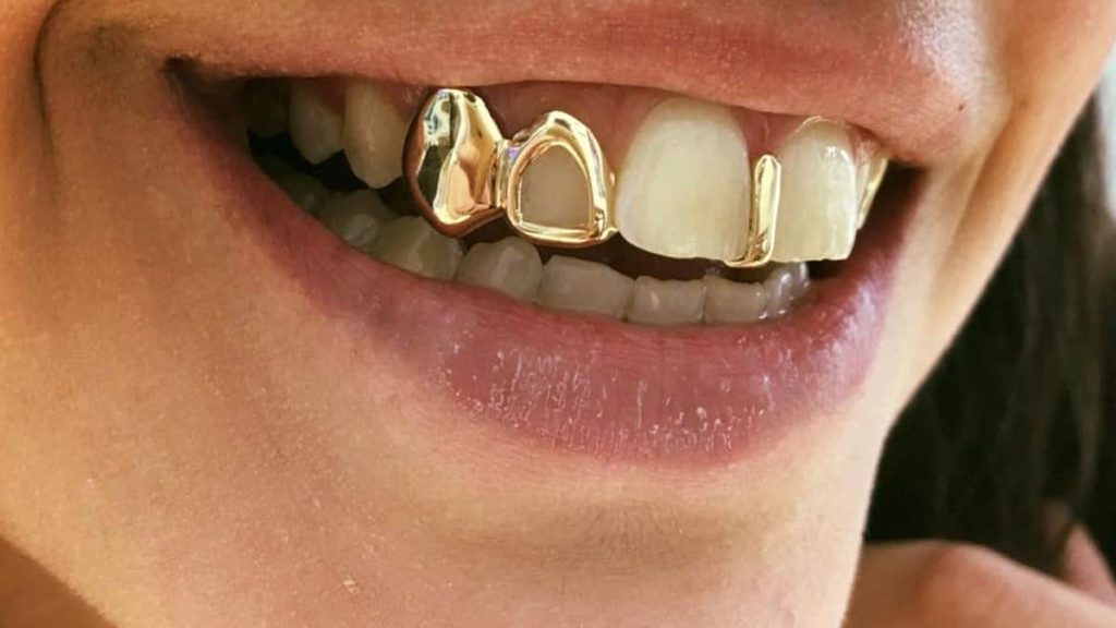 The Dos of Wearing Grillz 