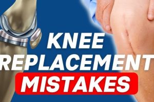 Mistakes After Knee Replacement